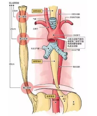 男子遭4cm鱼刺卡喉，一次意外的惊险经历